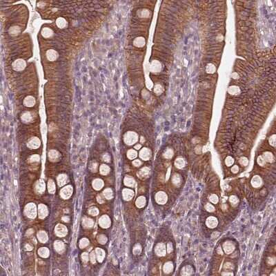 Immunohistochemistry: ITFG3 Antibody [NBP2-68926]