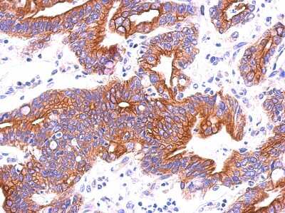 Immunohistochemistry-Paraffin: ITFG3 Antibody [NBP2-16999]