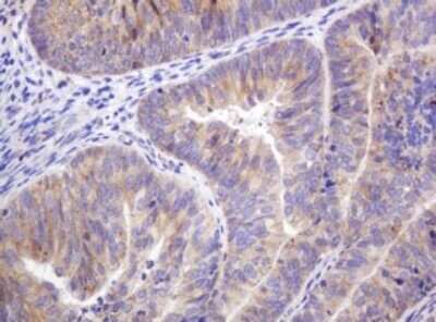 Immunohistochemistry: ITFG3 Antibody (OTI3B3) - Azide and BSA Free [NBP2-72253]