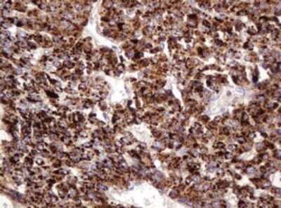Immunohistochemistry: ITFG3 Antibody (OTI3B3) - Azide and BSA Free [NBP2-72253]