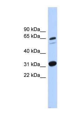 Western Blot: ITFG3 Antibody [NBP1-59854]