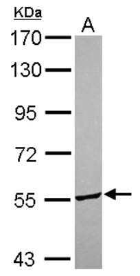 Western Blot: ITFG3 Antibody [NBP2-16999]