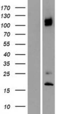 Western Blot: Integrin alpha 8 Overexpression Lysate [NBP2-07971]