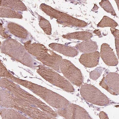 Immunohistochemistry-Paraffin: ITGB1BP3 Antibody [NBP2-56059]