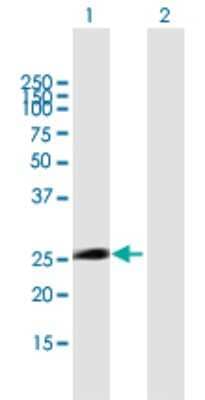 Western Blot: ITGB1BP3 Antibody [H00027231-B01P]