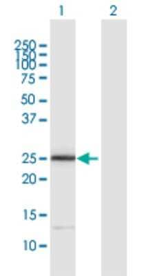 Western Blot: ITGB1BP3 Antibody [H00027231-D01P]