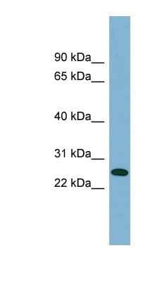 Western Blot: ITGB1BP3 Antibody [NBP1-53033]