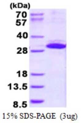 SDS-PAGE: Recombinant Human ITGB1BP3 His Protein [NBP2-23286]