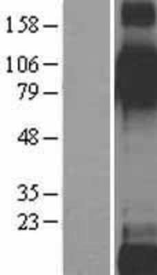 Western Blot: Integrin beta 6 Overexpression Lysate [NBL1-12075]