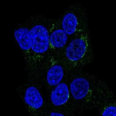 Immunocytochemistry/ Immunofluorescence: ITIH2 Antibody [NBP2-31750]