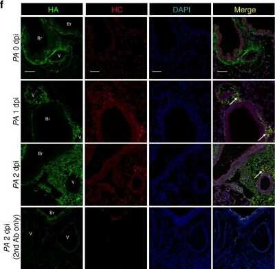 Immunocytochemistry/ Immunofluorescence: ITIH2 Antibody [NBP2-31750]