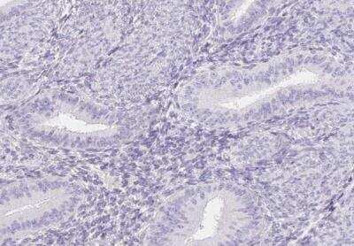 Immunohistochemistry-Paraffin: ITIH2 Antibody [NBP2-31750]