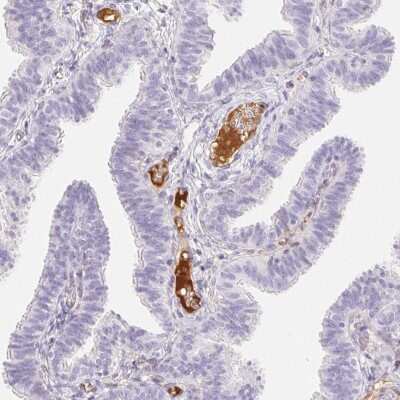 Immunohistochemistry-Paraffin: ITIH2 Antibody [NBP2-31750]