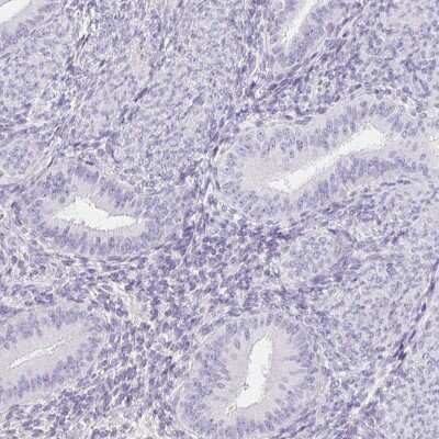 Immunohistochemistry-Paraffin: ITIH2 Antibody [NBP2-31750]