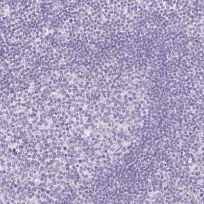 Immunohistochemistry-Paraffin: ITIH2 Antibody [NBP2-31750]