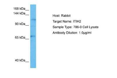 Western Blot: ITIH2 Antibody [NBP2-83087]