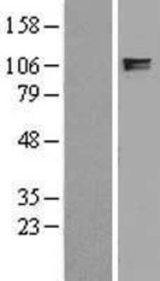 Western Blot: ITIH2 Overexpression Lysate [NBL1-12078]