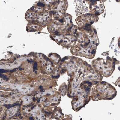 Immunohistochemistry-Paraffin: ITIH3 Antibody [NBP1-93705]