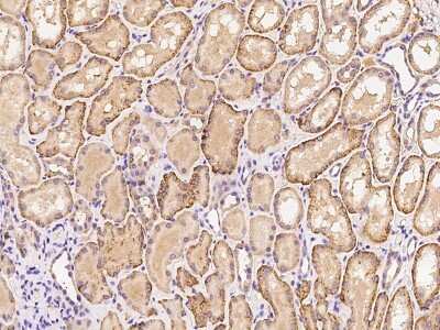 Immunohistochemistry-Paraffin: ITIH3 Antibody [NBP2-97601]