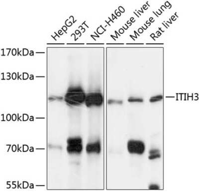 Western Blot: ITIH3 AntibodyAzide and BSA Free [NBP3-04982]