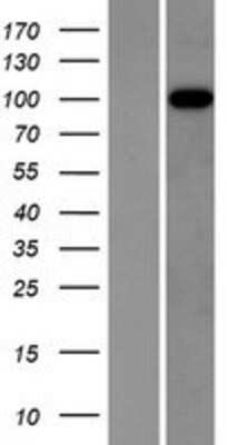 Western Blot: ITIH3 Overexpression Lysate [NBP2-08134]