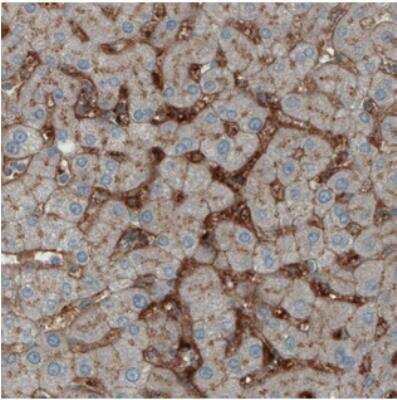 Immunohistochemistry: ITIH4 Antibody (CL1858) [NBP2-34492]