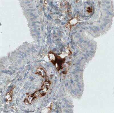 Immunohistochemistry: ITIH4 Antibody (CL1858) [NBP2-34492]