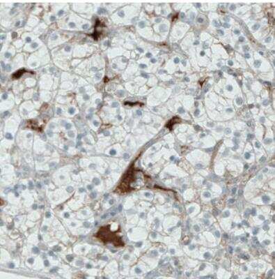 Immunohistochemistry: ITIH4 Antibody (CL1858) [NBP2-34492]