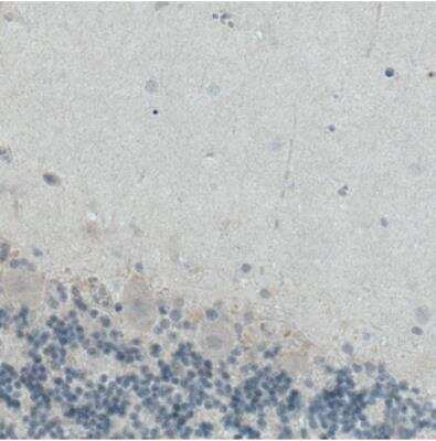 Immunohistochemistry: ITIH4 Antibody (CL1858) [NBP2-34492]