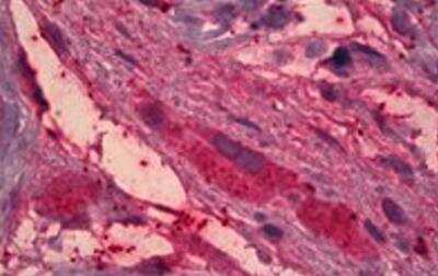 Immunohistochemistry-Paraffin: ITIH4 Antibody [NBP1-78286]