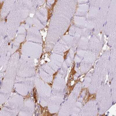 Immunohistochemistry-Paraffin: ITIH4 Antibody [NBP1-81777]