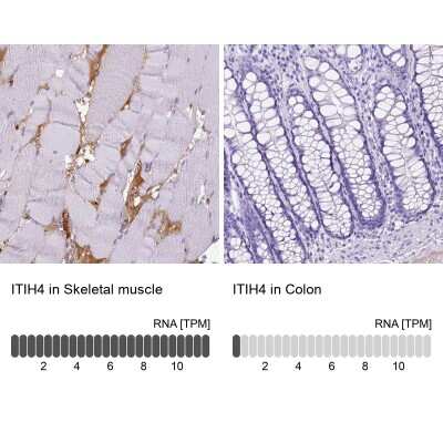 Immunohistochemistry-Paraffin: ITIH4 Antibody [NBP1-81777]