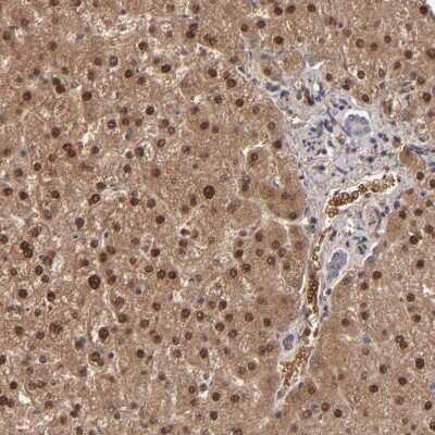 Immunohistochemistry-Paraffin: ITIH4 Antibody [NBP1-81778]