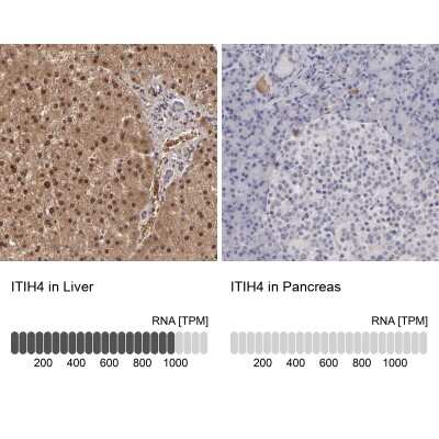 Immunohistochemistry-Paraffin: ITIH4 Antibody [NBP1-81778]