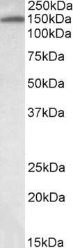 Western Blot: ITIH4 Antibody [NBP1-78286]