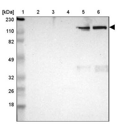 Western Blot: ITIH4 Antibody [NBP1-81777]