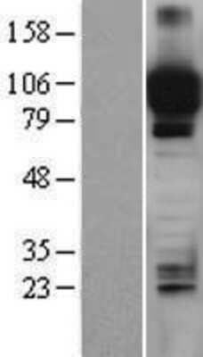 Western Blot: ITIH4 Overexpression Lysate [NBP2-04218]