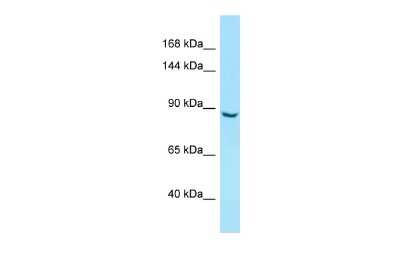 Western Blot: ITIH5 Antibody [NBP3-09494]