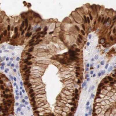 Immunohistochemistry: ITIH5L Antibody [NBP2-34207]