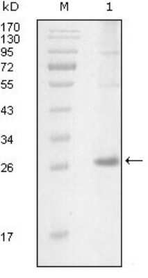 Western Blot: ITK Antibody (5G12C4)BSA Free [NBP1-28893]