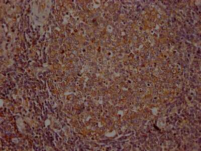 Immunohistochemistry: ITK Antibody (8F10) [NBP3-15208]