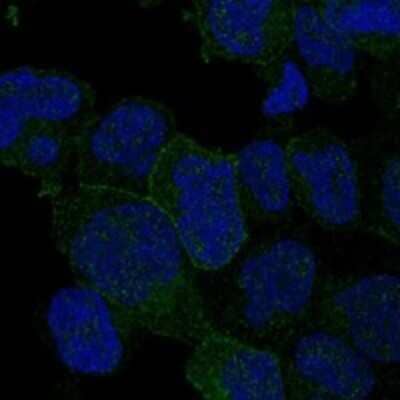 Immunocytochemistry/ Immunofluorescence: ITK Antibody [NBP3-17873]