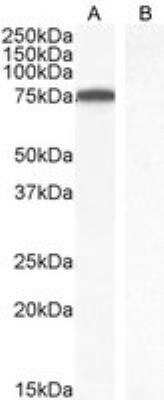 Western Blot: ITK Antibody [NB100-807]