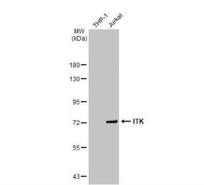 Western Blot: ITK Antibody [NBP1-31732]