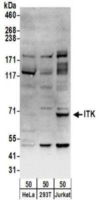 Western Blot: ITK Antibody [NBP2-32240]