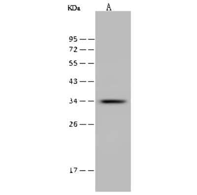 Western Blot: ITM2A Antibody [NBP2-99451]