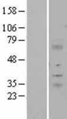 Western Blot: ITM2A Overexpression Lysate [NBL1-12081]