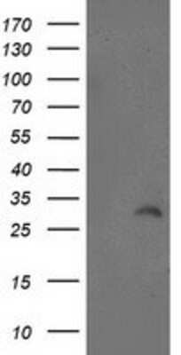 Western Blot: ITM2B Antibody (OTI1C11) [NBP2-00620]