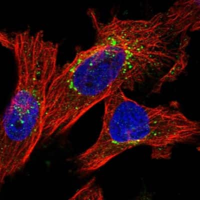 Immunocytochemistry/ Immunofluorescence: ITM2B Antibody [NBP1-88354]