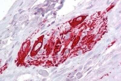 Immunohistochemistry-Paraffin: ITM2B Antibody [NBP1-36963]